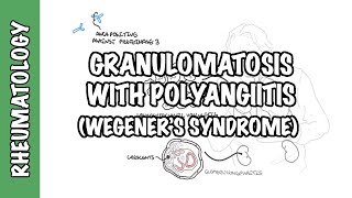 INFLAMMATION Part 9 Chronic Inflammation  GRANULOMATOUS INFLAMMATION [upl. by Crotty]