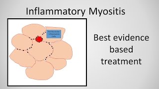 Myositis Inflammatory Myopathy Treatment [upl. by Awuhsoj]