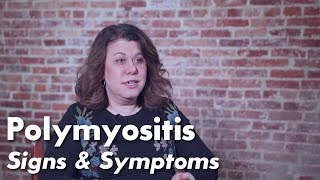 Polymyositis Signs amp Symptoms  Johns Hopkins Myositis Center [upl. by Carpet]