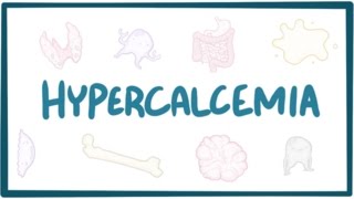 Hypercalcemia  causes symptoms diagnosis treatment pathology [upl. by Ronn]