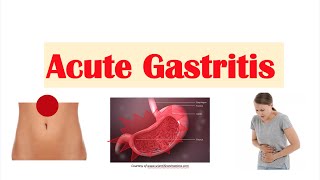 ASCITES  causespathophysiology dx and treatment by DoctScape [upl. by Cartwell]