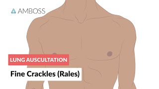 Fine Crackles Rales  Lung Auscultation  Episode 2 [upl. by Nicole]