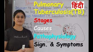 Pulmonary Tuberculosis in Hindi  Stages  Causes  Pathophysiology  Sign amp Symptoms [upl. by Zizaludba]