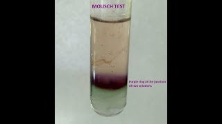 Molisch Testa group test for Carbohydrates [upl. by Avan]