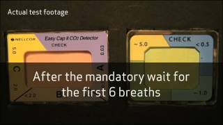 A new colorimetric CO2 detector for verifying correct tracheal intubation [upl. by Thrasher]