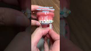 Easier Way to Floss with Braces  Platypus Floss [upl. by Anitsirhcairam334]