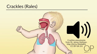 Respiratory Assessment by B Leary L DelSignore  OPENPediatrics [upl. by Reste910]