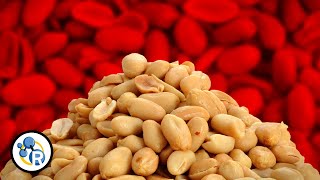 The Truth About Peanut Allergies [upl. by Manon]