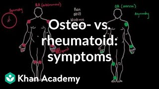 Osteoarthritis vs rheumatoid arthritis symptoms  NCLEXRN  Khan Academy [upl. by Hart947]