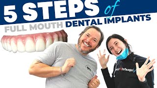 Dental Implant Procedure  Step by Step Guide [upl. by Chandra]