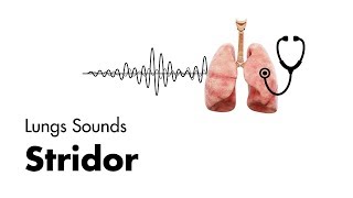 Stridor  Lung Sounds  MEDZCOOL [upl. by Atneuqal379]