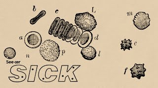 What Exactly is Lupus [upl. by Schiffman]