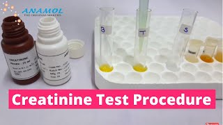 Serum Creatinine Test  Creatinine Blood Test [upl. by Oconnor660]