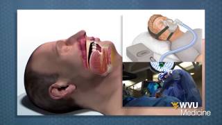 What Does Sleep Apnea Sound Like  How To Treat Sleep Apnea [upl. by Ahsemed]