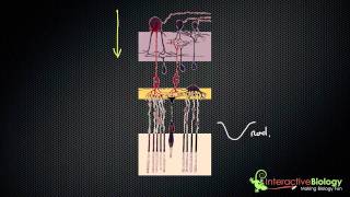 Torn Retina Laser Surgery Photocoagulation [upl. by Anoyek]