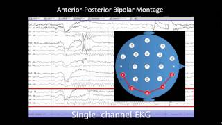 Introduction to EEG [upl. by Priscilla]