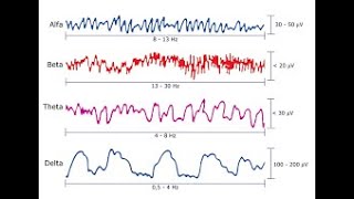 Electroencefalograma [upl. by Aven590]