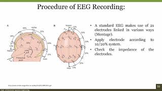 Learn to Read EEGs Part 1 [upl. by Hauser]