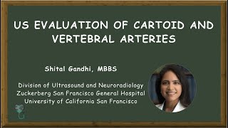 HowToPerform Carotid Doppler Step3 Vertebral artery [upl. by Ewart]