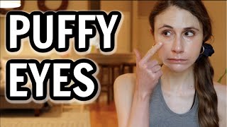 How to get rid of puffy eyes Dr Dray [upl. by Ahsaele]