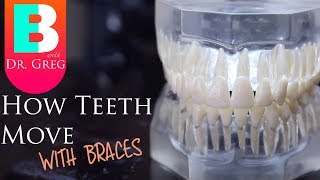 BRACES EXPLAINED How Teeth Move  Braces Work [upl. by Eras428]