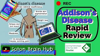 Addisons Disease Rapid Review [upl. by Maynord]