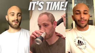 Bald Men Describe Going Bald For The First Time INSPIRATION [upl. by Mosnar]