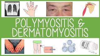 Polymyositis and Dermatomyositis in 3 Minutes [upl. by Arrotal806]