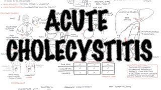 pathophysiology of ascites [upl. by Neras]