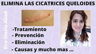 CICATRICES QUELOIDES ▶ Causas prevención y tratamientos ✅ [upl. by Esirahc]