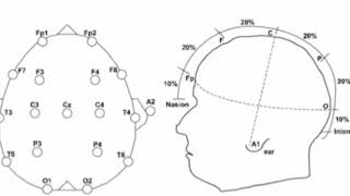 Electroencephalograph EEG [upl. by Merl]