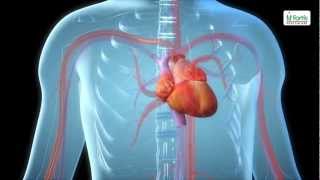 post processing of CT carotid angiogram [upl. by Kellyann645]