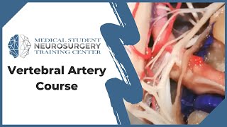 Vertebral Artery Course [upl. by Enomal585]