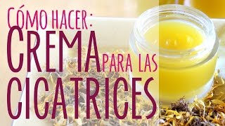 Crema casera para las cicatrices [upl. by Fridell754]