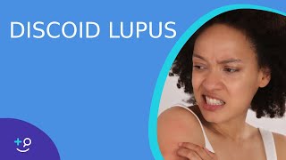 Discoid Lupus  Daily Dos of Dermatology [upl. by Ike309]