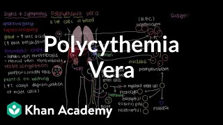 What is polycythemia vera  Hematologic System Diseases  NCLEXRN  Khan Academy [upl. by Harelda666]